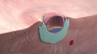 Implantation of the blastocyst [upl. by Shiri593]