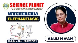 WUCHERERIA ELEPHANTIASIS II BY ANJU MAM II SCIENCE PLANET II [upl. by Adnaerb]