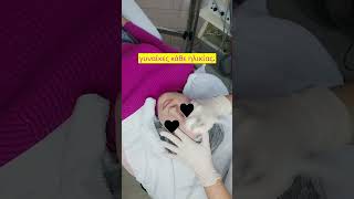 Δερμοαπόξεση με διαμάντια 💎💎 dermabrasion δερμοαπόξεση beautyskin beautystorygr [upl. by Assej]