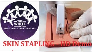 SKIN STAPLING  HD Demonstration [upl. by Mccord]