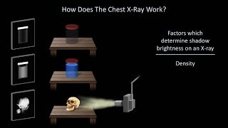 How to Interpret a Chest XRay Lesson 1  An Introduction [upl. by Courtland141]