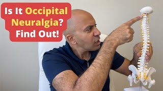 How to Diagnose Occipital Neuralgia [upl. by Booker]