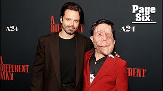 Sebastian Stan slams reporter for describing costar Adam Pearson as a ‘beast’ over disfigurement [upl. by Etterb732]