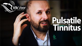 What causes tinnitus that sounds like a heartbeat [upl. by Pfister774]