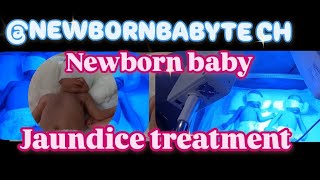 Newborn baby jaundice treatment in nicu  newbornbaby youtubeshorts babycare video nicunurse [upl. by Olnek]