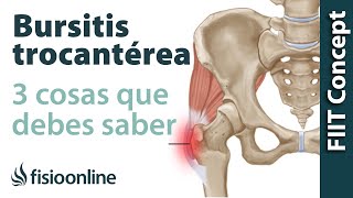 3 cosas que debes saber sobre la trocanteritis o bursitis trocantérea [upl. by Seabury]