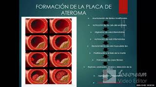 Cardiopatía isquémica I  AngioCardiología  sem 6 [upl. by Redmond]