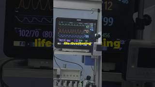 Understanding Heart Arrhythmia Quick Guide [upl. by Ernesto]