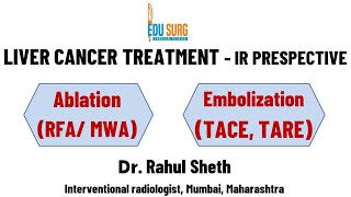 Ablation chemoembolization and radioembolization in primary liver cancer  hepatocellular carcinoma [upl. by Ellimak277]