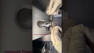 histopathology  epithelialtissue histopathology machine tissueculture patho frozensection [upl. by Aibar]