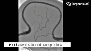 Master MMA Embolization with SurgeonsLabs Realistic Simulation Model  SurgeonsLab AG [upl. by Marguerite119]