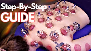 Have you been doing cupping therapy all WRONG [upl. by Terti621]