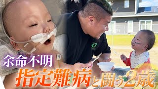 「ママ。僕頑張るよ」難病と闘う2歳の男の子の1日に密着 [upl. by Marbut660]