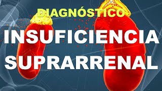 Cómo se diagnostica la Insuficiencia Suprarrenal [upl. by Refeinnej]