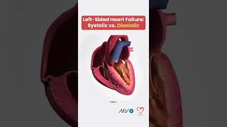 Systolic vs Diastolic Heart Failure 🫀 [upl. by Yekcor]