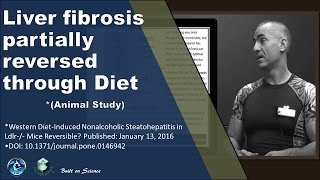 💚 Liver fibrosis partially reversed through Diet [upl. by Janie578]