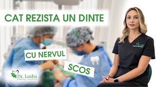 Cat rezista un dinte cu nervul scos  Clinicile Dentare Dr Leahu [upl. by Bak475]