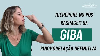 Raspagem de giba e micropore rinomodelacaodefinitiva rinoplastiaestruturada posoperatorio [upl. by Yerhpmuh]