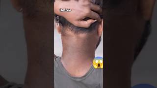 💯Dark Neck Removal Pack 😱shorts youtubeshorts viralreels trending skincare darkneck subscribe [upl. by Viridissa]