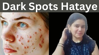 Dark Spots Remover Karne Ka Simple Tarika beautyblogdeepti [upl. by Ivett291]