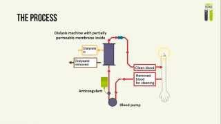 IGCSE Biology Revision  Part 1  Kidney Dialysis [upl. by Collin933]