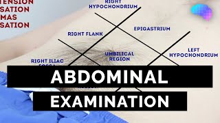 Abdominal Examination  OSCE Guide Latest  UKMLA  CPSA [upl. by Daffi562]