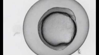 Zebrafish development movie  from gastrulation to 24 hours [upl. by Sabir]