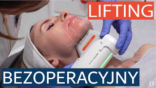 Bezoperacyjny lifting twarzy i ciała  HIFU Ultraskin II Absolute [upl. by Fernas]