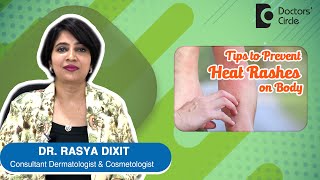 Cure for Heat Rashes  Sweat Rashes  By Dr Rasya Dixit  Doctors Circle [upl. by Rainer]