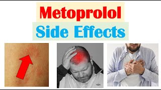 Metoprolol amp Beta Blockers Side Effects amp Why They Occur [upl. by Enirroc]