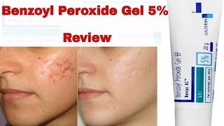 Benzoyl Peroxide Gel For Acne Treatment Review In Hindi 2019 [upl. by Goddart]