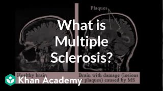 What is multiple sclerosis  Nervous system diseases  NCLEXRN  Khan Academy [upl. by Llebana]