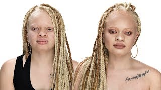 MAKEUP TUTORIAL FOR WOMEN WITH ALBINISM ft fenty beauty profilter foundation [upl. by Bethel]