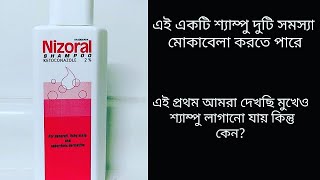 Nizoral shampoo review in bangla Nizoral shampoo কিভাবে চেহারা র fungal acne কমায় জেনে নিন [upl. by Philana]