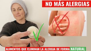 Como Eliminar Tu Alergia  Crema Natural para aliviar la picazón fácil y econóimica [upl. by Meeker472]