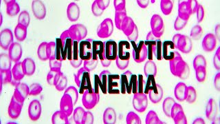 Microcytic Anemia updated 2021  CRASH Medical Review Series [upl. by Aener739]