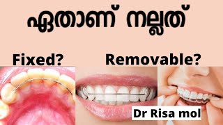 Retainers After Braces  Clear Retainer  Fixed and Removable retainer Pallil kambi idunnath [upl. by Aiyot]