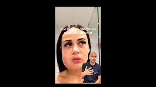 Jaw Filler Swelling Whats happened  Doctor Reacts [upl. by Airednaxela]