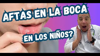 Gingivoestomatitis en niños Todo lo que necesitas saber sobre ampollas bucales [upl. by Yengac998]