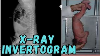 Invertogram Xray ll Invertogram procedure ll Invertogram Xray Position ll How to do invertogram ll [upl. by Zephaniah709]