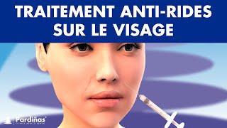 Acide hyaluronique sur le VISAGE ou botox  Traitement ANTI RIDES © [upl. by Nolava651]