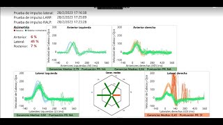 Neuritis vestibular 7 semanas de evolución  Mi vivencia rehabilitación vértigos mareos [upl. by Korfonta945]