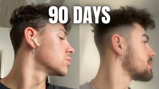 How To GROW A BEARD In 90 Days Using MINOXIDIL amp DERMA ROLLER [upl. by Lirba]