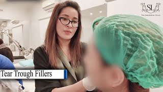 Tear Trough fillers  Under Eye Treatment  Dr Shaista lodhi from The Aesthetics Clinic [upl. by Nodnarbal]