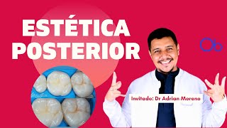 Estética Posterior 🦷 con el Dr Adrian Moreno [upl. by Valaree]