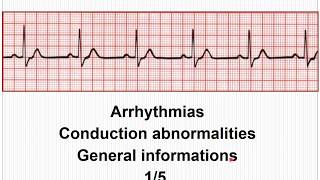 ECG Arrhythmias Conduction abnormalities  General concept 15 [upl. by Enair]