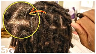 Why You Should Retwist Your Dreadlocks [upl. by Selway676]