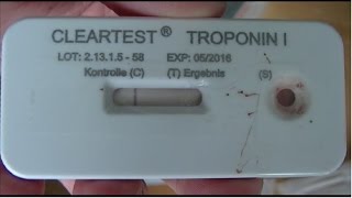 Troponin I zelftest HOWTO [upl. by Urissa]