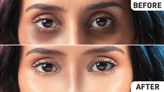 How to Get Rid of UnderEye Dark Circles  Dr Shereene Idriss [upl. by Valoniah]