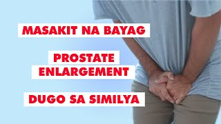 Q amp A  MASAKIT NA PUSON PROSTATE ENLARGEMENT MASAKIT NA BAYAG DUGO SA SIMILYA ATBP [upl. by Irena860]